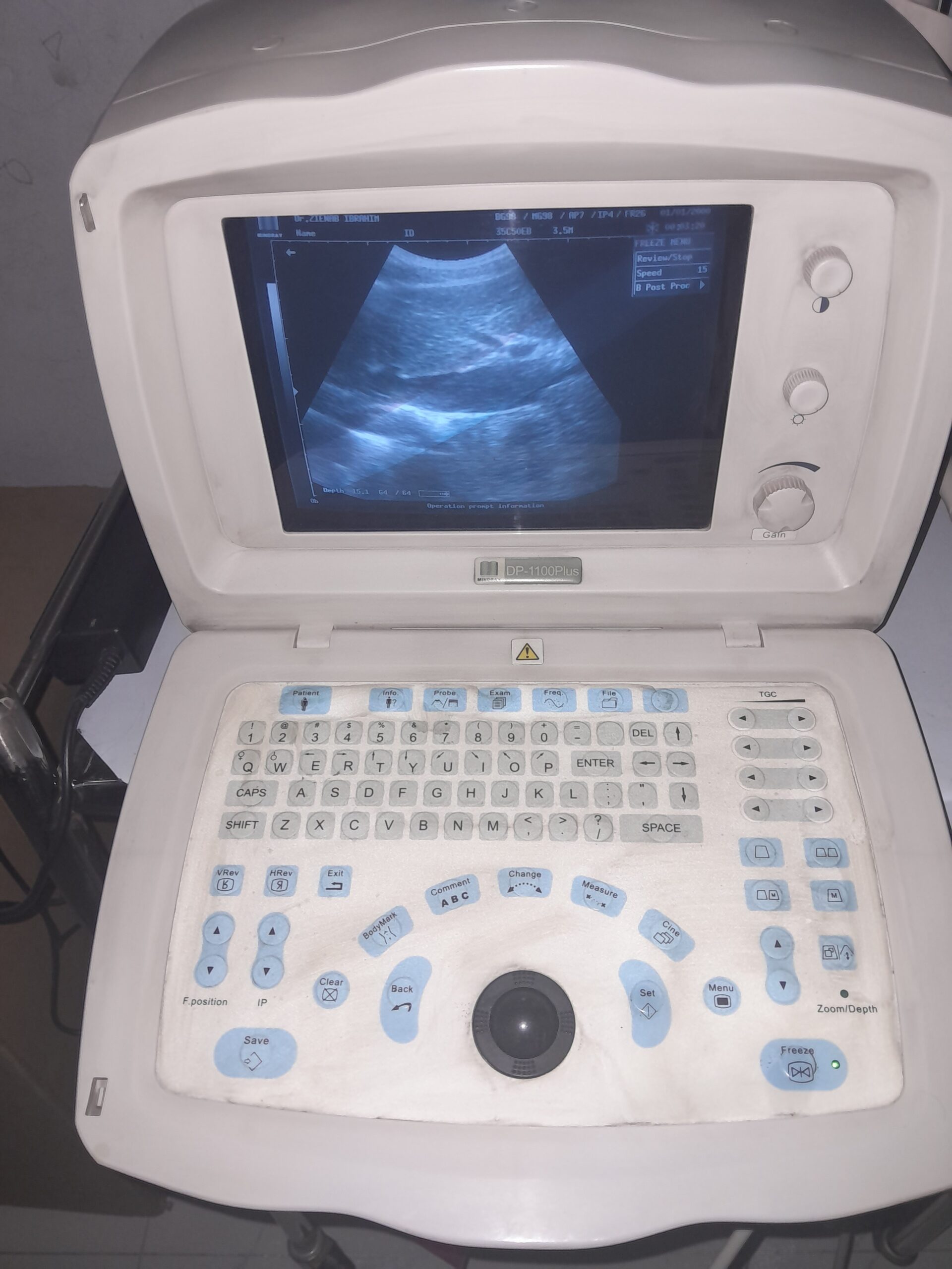 مستعمل 2 بروب كونفكس و فاجينال Dp 1100 plusسونار نسا ماركه مندراى موديل - Image 2